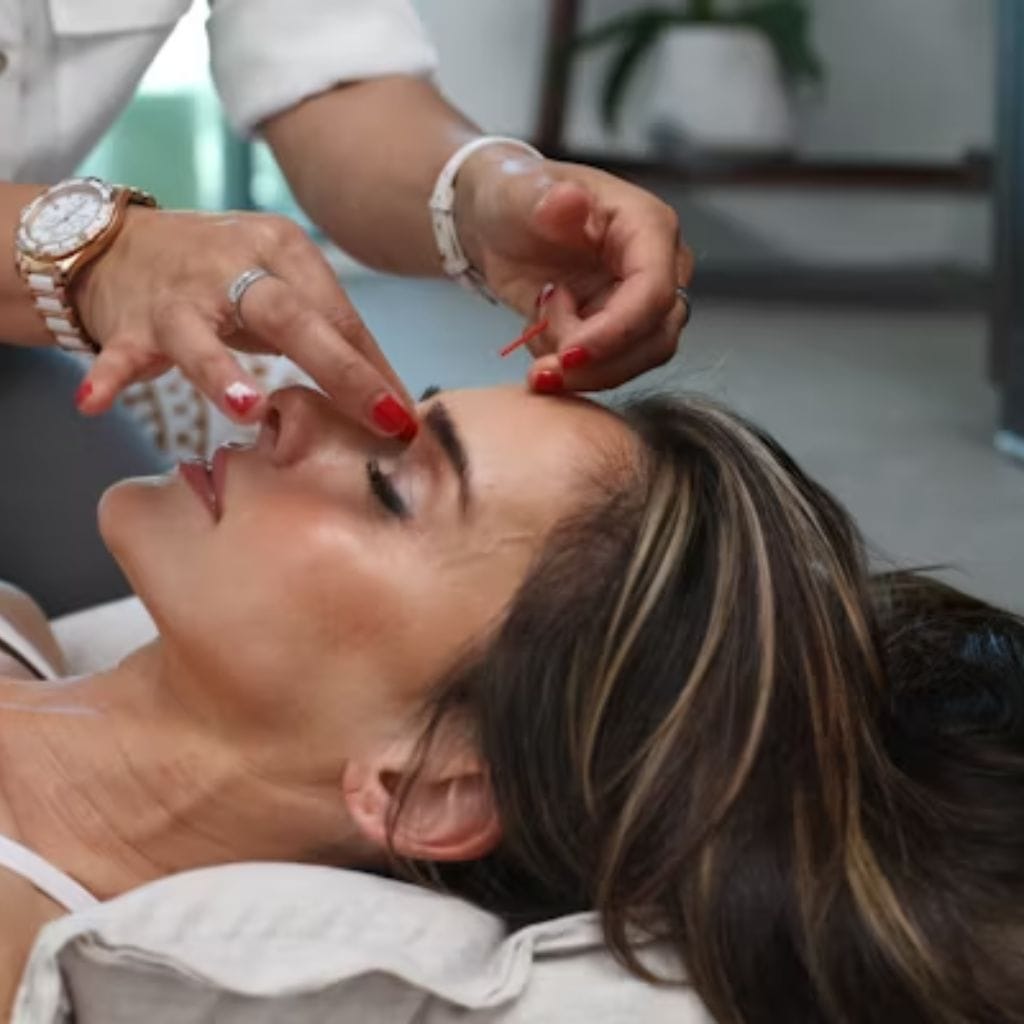 A woman receiving facial acupuncture from a practitioner. ___Write for us health and beauty