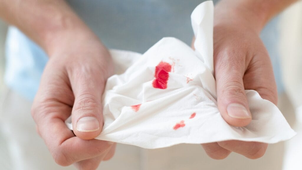 Close-up of hands holding a white cloth with red blood-like stains—how to get blood out of clothes illustrated on fabric.